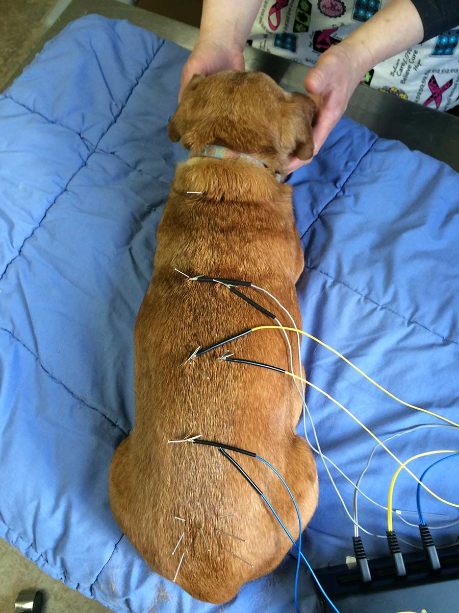 Acupuncture