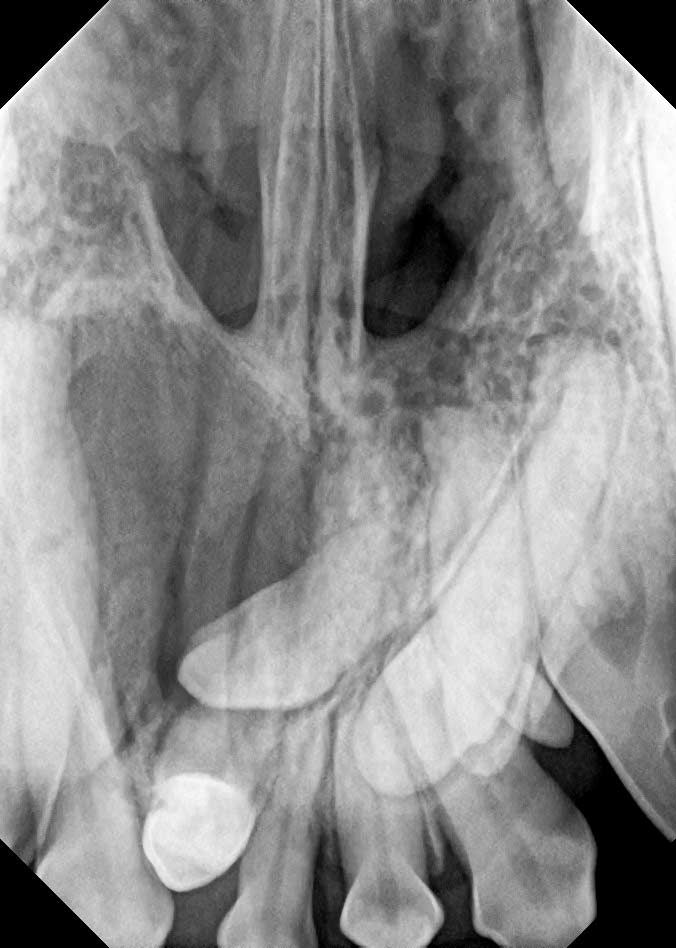 Advanced Dental Treatments