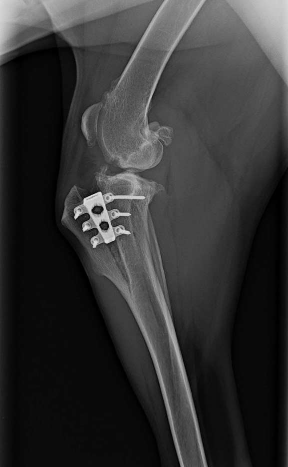 X-ray of pinned bone